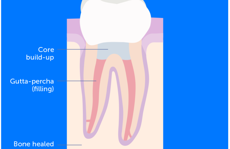 Endodontics-featured-image