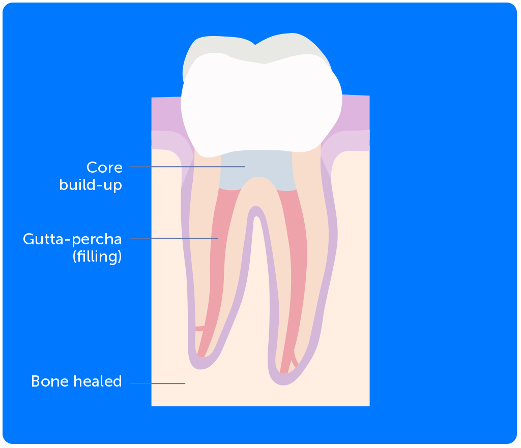 Endodontics-featured-image